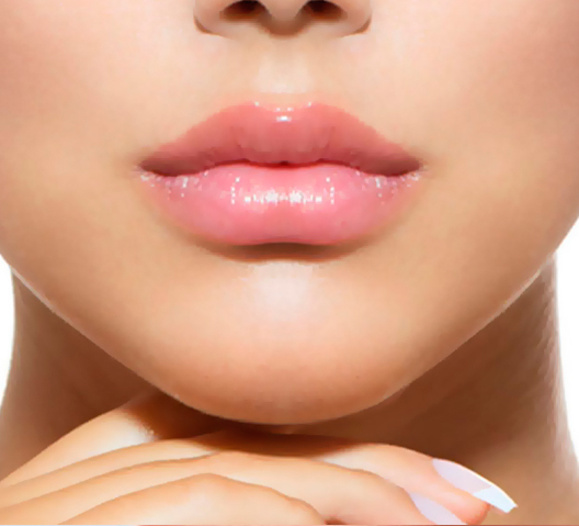 genioplastia