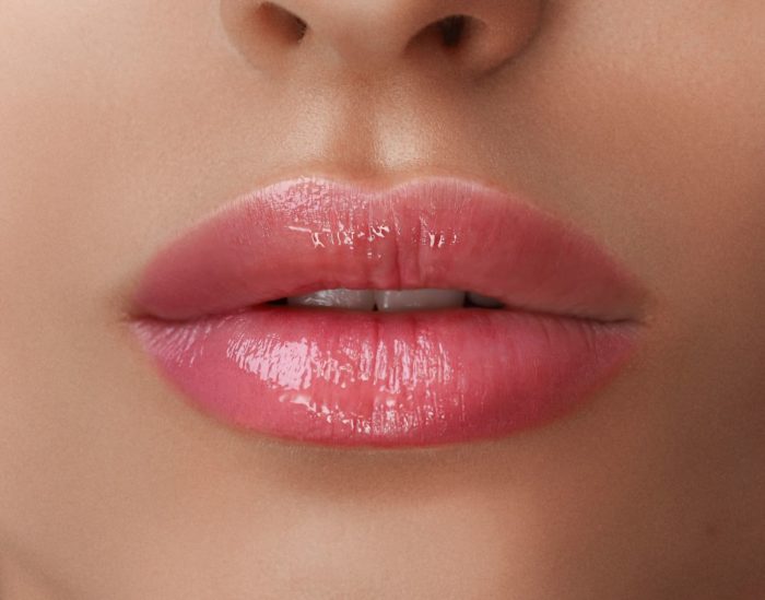 Relleno de Labios